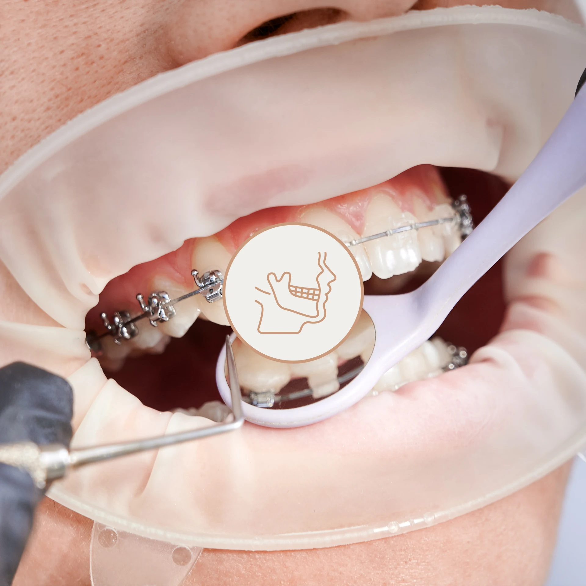 Ιατρείο Τσουμής εικόνα σιδεράκια