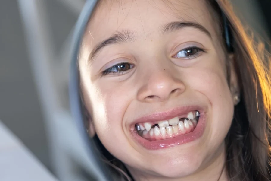 Orthodontikos-siderakia-thessaloniki-Konstantinos-Tsoumis-02